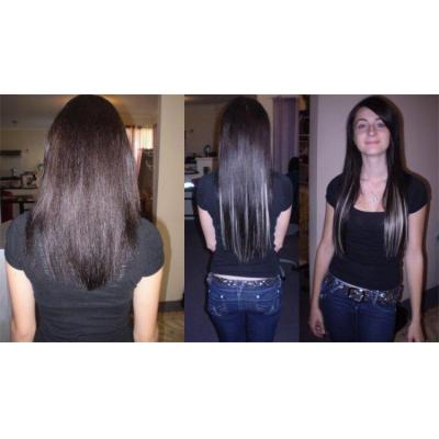 Before & After