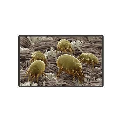 Dust mites are microscopic spiders feasting on your dead skin. Their faeces trigger allergy attacks like Asthma, Eczema, Skin Rashes