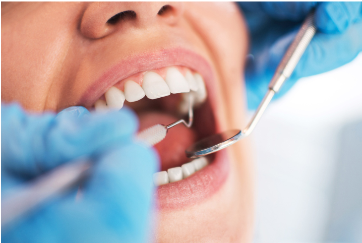 ROOT CANAL TREATMENT