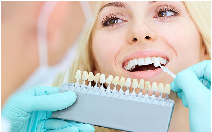 TEETH WHITENING