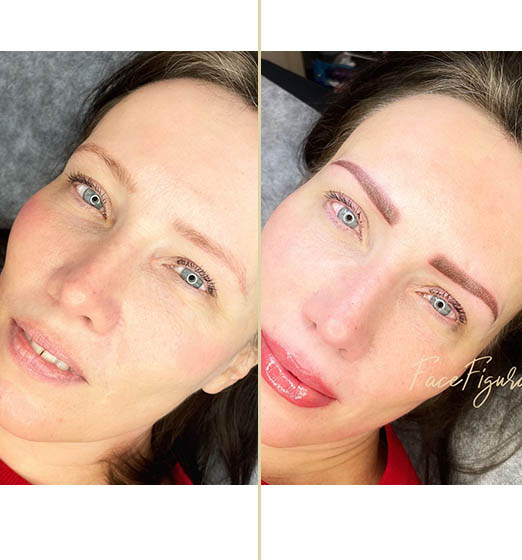 Cosmetic Tattoo Brisbane