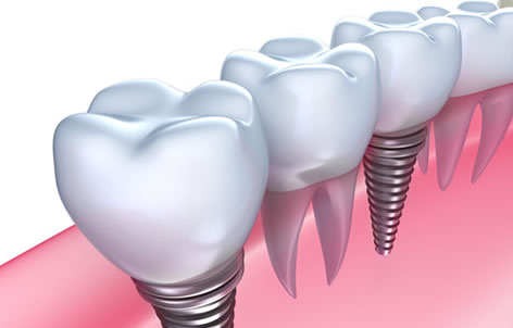 No Gap Dentists